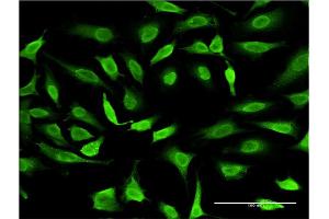 Immunofluorescence of monoclonal antibody to SMAD7 on HeLa cell.