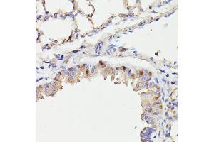 Immunohistochemistry of paraffin-embedded mouse lung using CDC23 antibody (ABIN7266248) at dilution of 1:100 (40x lens).