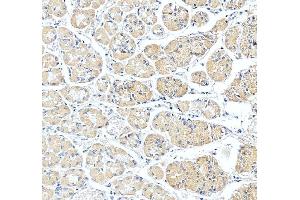 IHC analysis of SLC25A23 using anti-SLC25A23 antibody (ABIN7600165).