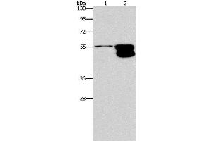 Western Blot analysis of NIH/3T3 cell and Mouse brain tissue using CRHR2 Polyclonal Antibody at dilution of 1:650 (CRHR2 anticorps)