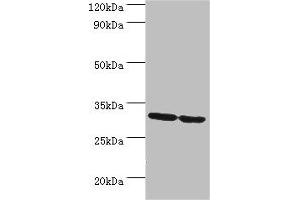Western blot All lanes: PNP antibody at 10 μg/mL Lane 1: Jurkat whole cell lysate Lane 2: K562 whole cell lysate Secondary Goat polyclonal to rabbit IgG at 1/10000 dilution Predicted band size: 32 kDa Observed band size: 32 kDa (PNP anticorps  (AA 1-289))