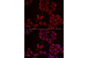 Immunofluorescence analysis of U2OS cells using MSRA antibody. (MSRA anticorps)