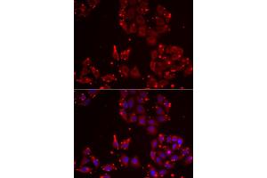 Immunofluorescence analysis of U2OS cells using MSRA antibody. (MSRA anticorps)