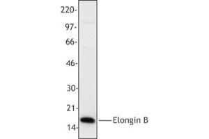 Image no. 1 for anti-Transcription Elongation Factor B (SIII), Polypeptide 2 (18kDa, Elongin B) (TCEB2) antibody (ABIN205406) (TCEB2 anticorps)