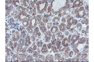 Image no. 1 for anti-Crystallin, Zeta, Homolog antibody (ABIN1497654)