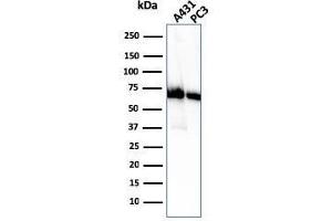 Western Blot Analysis of A431 and PC-3 cell lysate using CD73 Mouse Monoclonal Antibody (NT5E/2505). (CD73 anticorps)