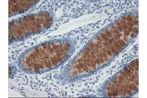 Image no. 1 for anti-Adaptor-Related Protein Complex 2, mu 1 Subunit (AP2M1) (AA 97-383) antibody (ABIN1491720)