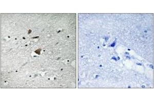 Immunohistochemistry analysis of paraffin-embedded human brain tissue, using APC1 (Ab-355) Antibody. (APC1 anticorps  (AA 321-370))