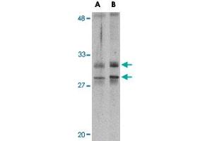 Western blot analysis of METTL7A in MCF-7 cell lysate with METTL7A polyclonal antibody  at 2 ug/mL . (METTL7A anticorps  (Internal Region))