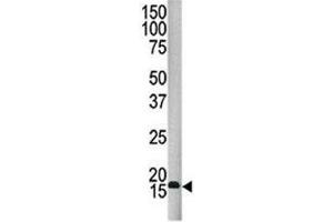 Western blot analysis of SUMO4 antibody and HepG2 lysate.
