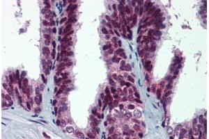 Human Prostate: Formalin-Fixed, Paraffin-Embedded (FFPE)
