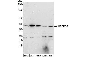 Western Blotting (WB) image for anti-Ubiquinol-Cytochrome C Reductase Core Protein II (UQCRC2) (AA 1-50) antibody (ABIN7450881)