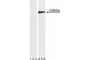 Western blot analysis of Tyk2 (pY1054/pY1055) in human Burkitt’s lymphoma. (TYK2 anticorps  (pTyr1054))