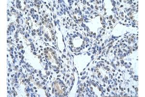 Rabbit Anti-KRT17 Antibody       Paraffin Embedded Tissue:  Human alveolar cell   Cellular Data:  Epithelial cells of renal tubule  Antibody Concentration:   4. (KRT17 anticorps  (C-Term))