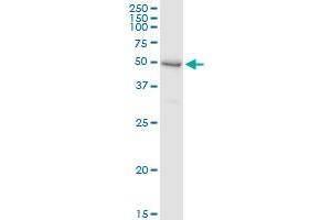 Immunoprecipitation of SHPK transfected lysate using anti-SHPK MaxPab rabbit polyclonal antibody and Protein A Magnetic Bead , and immunoblotted with SHPK purified MaxPab mouse polyclonal antibody (B01P) .