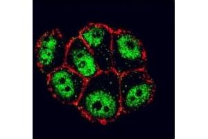 Confocal immunofluorescent analysis of IkB alpha antibody with ZR-75-1 cells followed by Alexa Fluor 488-conjugated goat anti-rabbit lgG (green).