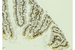 ABIN6267241 at 1/100 staining Mouse colon tissue by IHC-P.