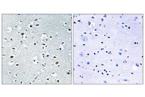 Immunohistochemistry analysis of paraffin-embedded human brain tissue using PPRC1 antibody. (PPRC1 anticorps  (C-Term))