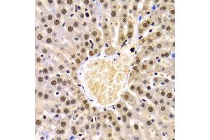 Immunohistochemistry of paraffin-embedded Rat liver using PELP1 antibody at dilution of 1:100 (x400 lens). (PELP1 anticorps  (AA 1021-1180))