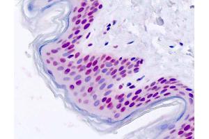 Human, Skin: Formalin-Fixed Paraffin-Embedded (FFPE) (FOXD1 anticorps  (AA 1-30))