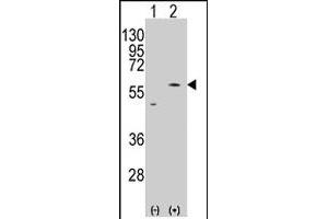 Western blot analysis of PMAT (SLC29A4) (arrow) using rabbit SLC29A4 polyclonal antibody . (SLC29A4 anticorps  (AA 459-489))