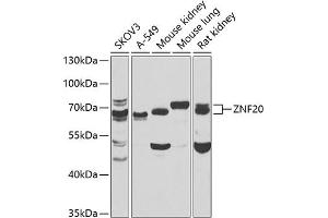 Western blot analysis of extracts of various cell lines, using ZNF20 antibody  at 1:1000 dilution. (ZNF20 anticorps  (AA 1-200))