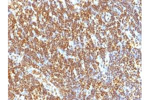 Formalin-fixed, paraffin-embedded human Tonsil stained with SUMO-2 Monoclonal Antibody (SUMO2/1199)