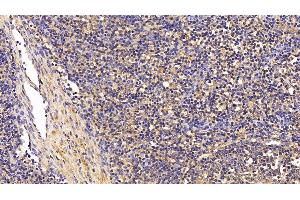 Detection of TGFb1 in Porcine Lymph node Tissue using Polyclonal Antibody to Transforming Growth Factor Beta 1 (TGFb1)