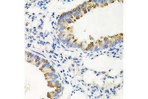 Immunohistochemistry of paraffin-embedded mouse lung using IRAK2 antibody. (IRAK2 anticorps)