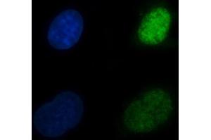 IF analysis of CBR1 using anti-CBR1 antibody (ABIN7600015). (CBR1 anticorps  (AA 14-262))