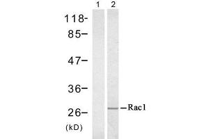 Western blot analysis of extract from A431 cell untreated or treated with EGF (200ng/ml, 5min), using Rac1 (Ab-71) antibody (E021201). (RAC1 anticorps)