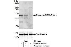 Western Blotting (WB) image for anti-Structural Maintenance of Chromosomes 3 (SMC3) (pSer1083) antibody (ABIN7451026)