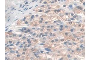 Detection of GAMT in Rat Stomach Tissue using Polyclonal Antibody to Guanidinoacetate-N-Methyltransferase (GAMT)