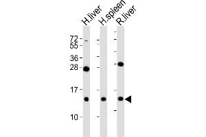 All lanes : Anti-CXCL11 Antibody at 1:2000 dilution Lane 1: human liver lysates Lane 2: human spleen lysates Lane 3: rat liver lysates Lysates/proteins at 20 μg per lane.