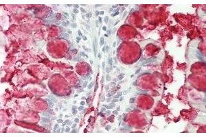 Detection of TFF3 in Human Small Intestine Tissue using Polyclonal Antibody to Trefoil Factor 3 (TFF3)