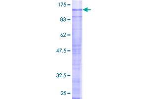 Image no. 1 for SFRS Protein Kinase 2 (SRPK2) (AA 1-688) protein (GST tag) (ABIN1321348)