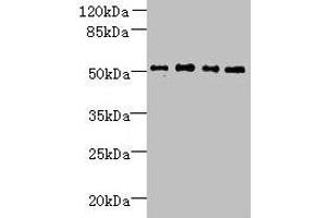 Western blot All lanes: TTC38 antibody at 1. (TTC38 anticorps  (AA 2-200))