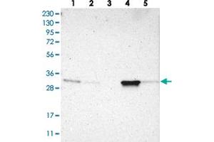 Western blot analysis of Lane 1: RT-4, Lane 2: U-251 MG, Lane 3: Human Plasma, Lane 4: Liver, Lane 5: Tonsil with LHPP polyclonal antibody  at 1:250-1:500 dilution. (LHPP anticorps)