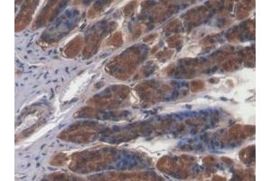 Detection of CAMK2a in Rat Stomach Tissue using Polyclonal Antibody to Calcium/Calmodulin Dependent Protein Kinase II Alpha (CAMK2a)