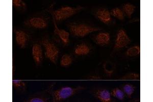 Immunofluorescence analysis of U-2 OS cells using PPP2CB Polyclonal Antibody at dilution of 1:100.