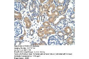 Rabbit Anti-APOBEC3D Antibody  Paraffin Embedded Tissue: Human Kidney Cellular Data: Epithelial cells of renal tubule Antibody Concentration: 4. (APOBEC3D anticorps  (N-Term))