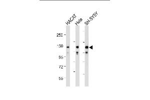 All lanes : Anti-SED Antibody (N-term) at 1:2000 dilution Lane 1: HACAT whole cell lysate Lane 2: Hela whole cell lysate Lane 3: SH-SY5Y whole cell lysate Lysates/proteins at 20 μg per lane.