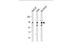 All lanes : Anti-SED Antibody (N-term) at 1:2000 dilution Lane 1: HACAT whole cell lysate Lane 2: Hela whole cell lysate Lane 3: SH-SY5Y whole cell lysate Lysates/proteins at 20 μg per lane. (SEMA6D anticorps  (N-Term))