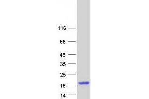 Defensin, alpha 5, Paneth Cell-Specific (DEFA5) protein (Myc-DYKDDDDK Tag)
