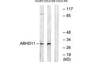 Western blot analysis of extracts from COLO/HuvEc cells, using ABHD11 Antibody. (ABHD11 anticorps  (AA 161-210))