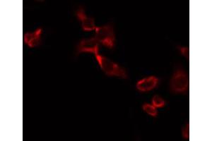 ABIN6274729 staining A549 by IF/ICC.