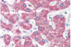 Human Liver (formalin-fixed, paraffin-embedded) stained with KIAA0152 antibody ABIN351427 at 5 ug/ml followed by biotinylated goat anti-rabbit IgG secondary antibody ABIN481713, alkaline phosphatase-streptavidin and chromogen.