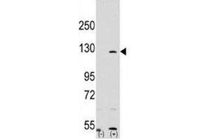 Western blot analysis of PARP antibody and 293 cell lysate (2 ug/lane) either nontransfected (Lane 1) or transiently transfected with the PARP1 gene (2). (PARP1 anticorps  (AA 183-214))
