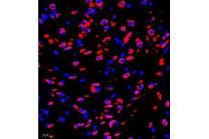 Immunofluorescence of paraffin embedded rat brain using P4H (ABIN7074215) at dilution of 1:700 (400x lens) (HIF Prolyl Hydroxylase anticorps)
