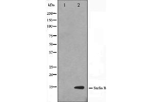 Western blot analysis on A549 cell lysate using CSTB Antibody,The lane on the left is treated with the antigen-specific peptide. (CSTB anticorps  (C-Term))